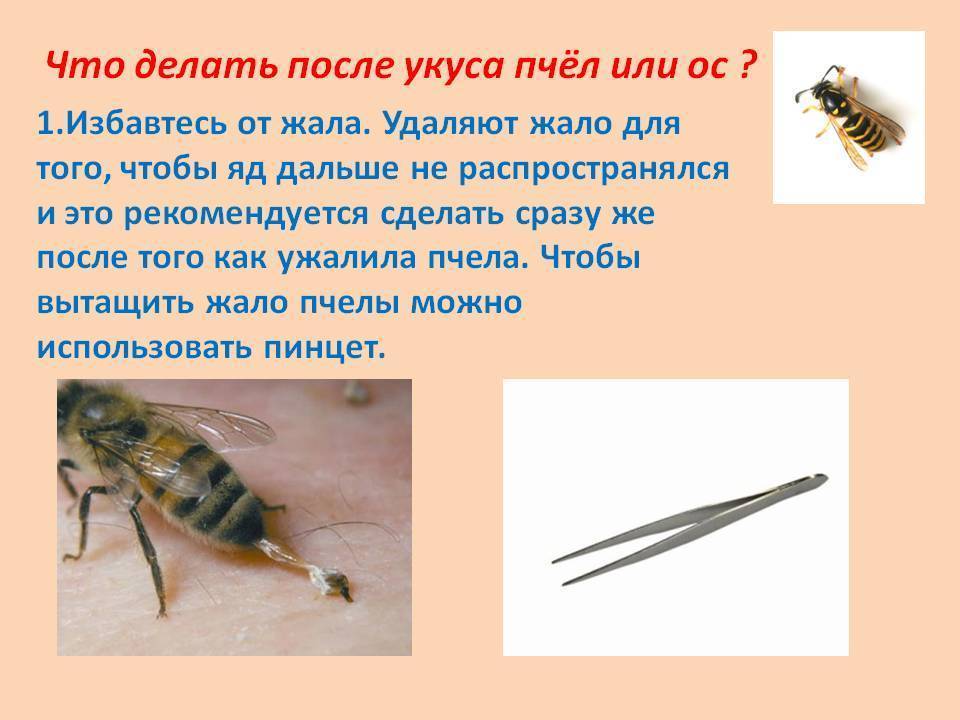 Аллергия на насекомых - симптомы, причины, профилактика и лечение