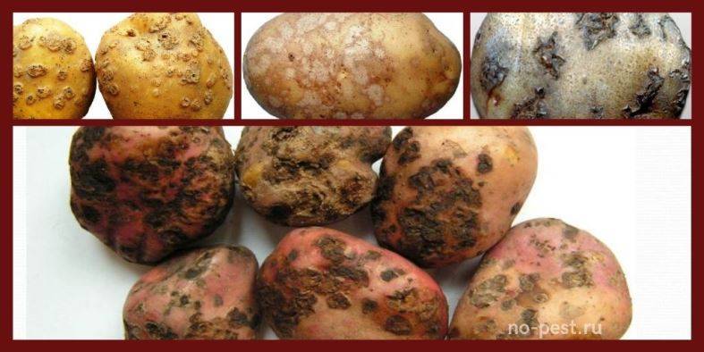 Парша обыкновенная картофеля