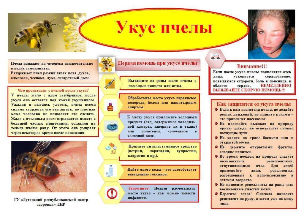 Что делать, если пчела укусила в голову, глаз, шею, руку, палец, ногу