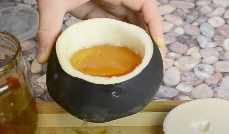 Сухой кашель у ребенка