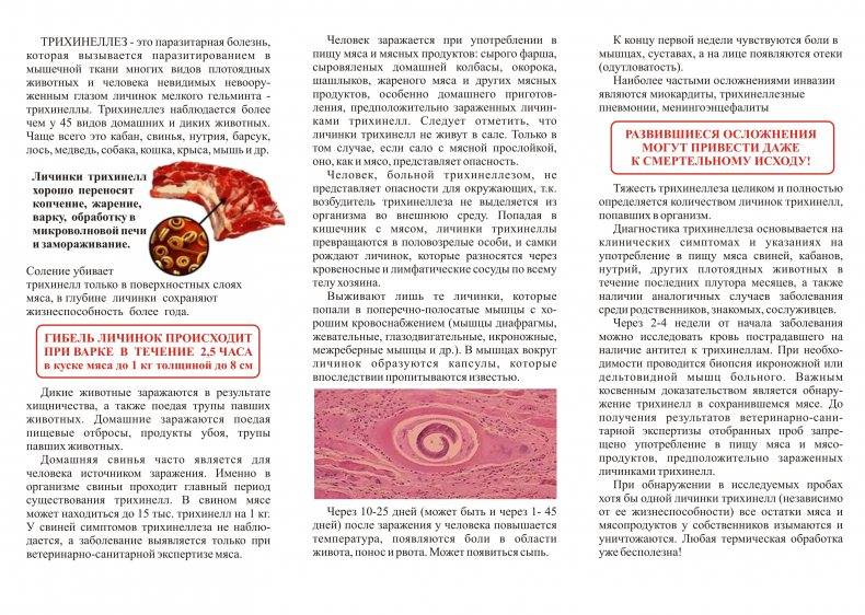 Трихинеллез | университетская клиника