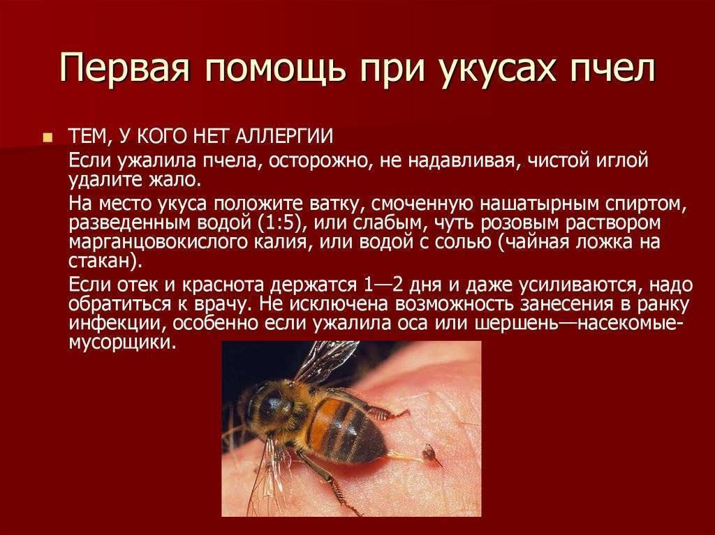 Первая помощь при укусе пчелы. что делать, если укусила пчела?