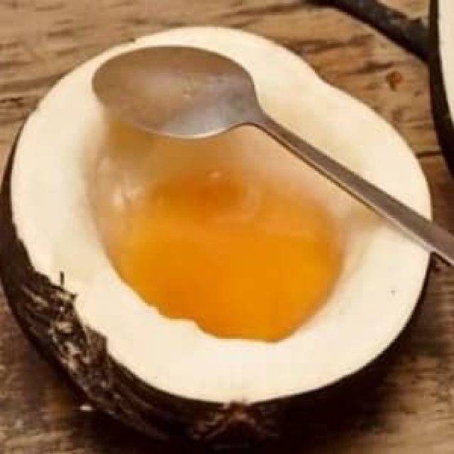 Аллергический бронхит