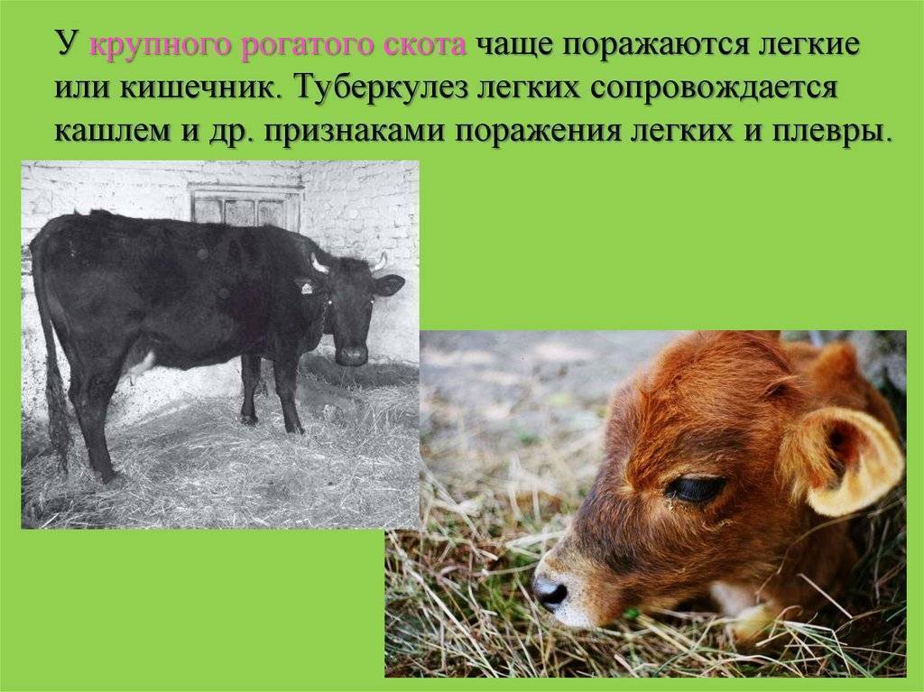Кт легких при туберкулезе
